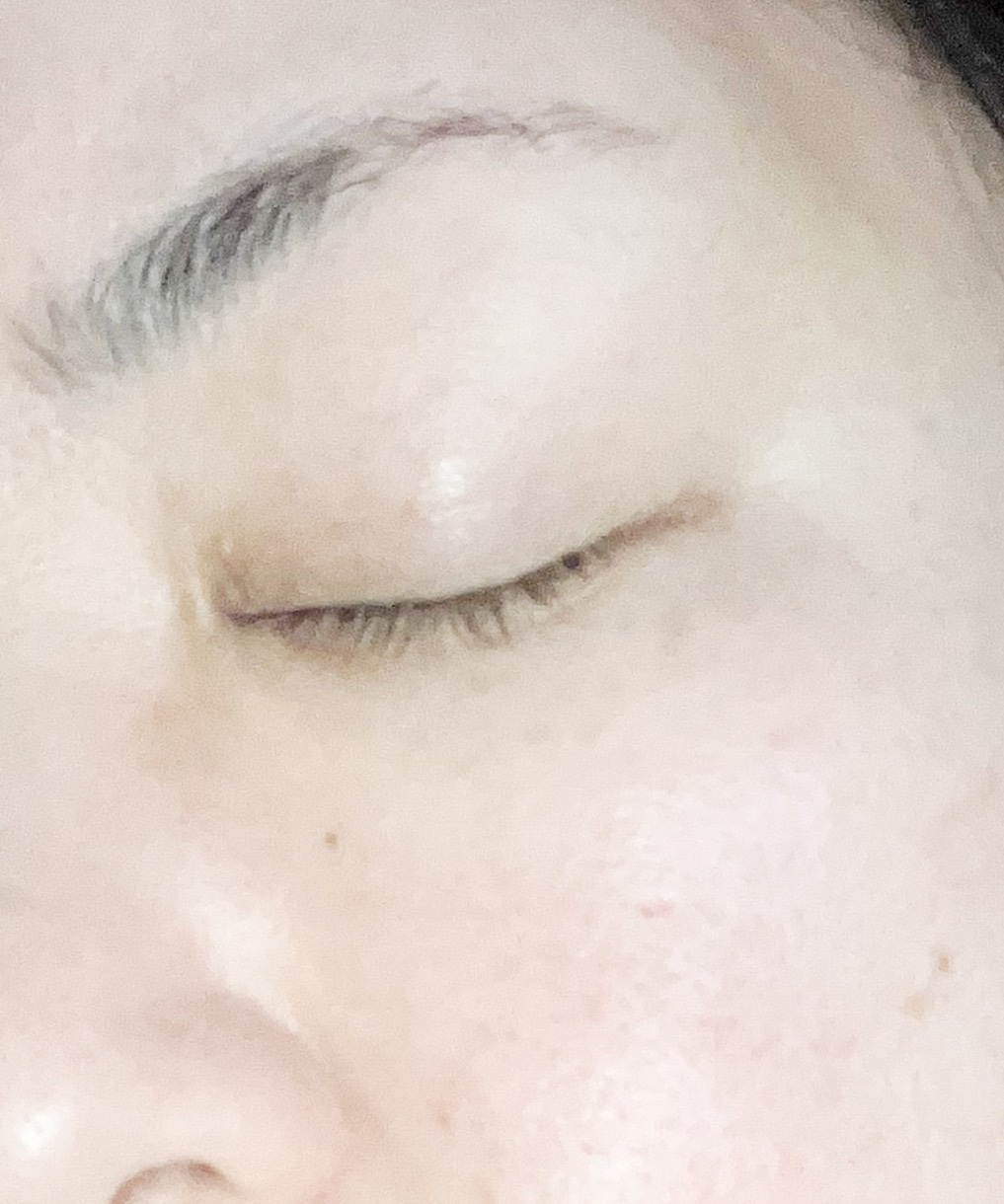 シカルファットプラス リペアミルク/アベンヌ/乳液を使ったクチコミ（3枚目）