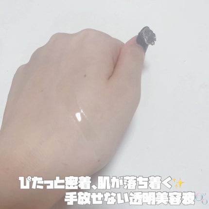 アゼライン酸15 インテンスカーミングセラム/Anua/美容液を使ったクチコミ(2枚目)