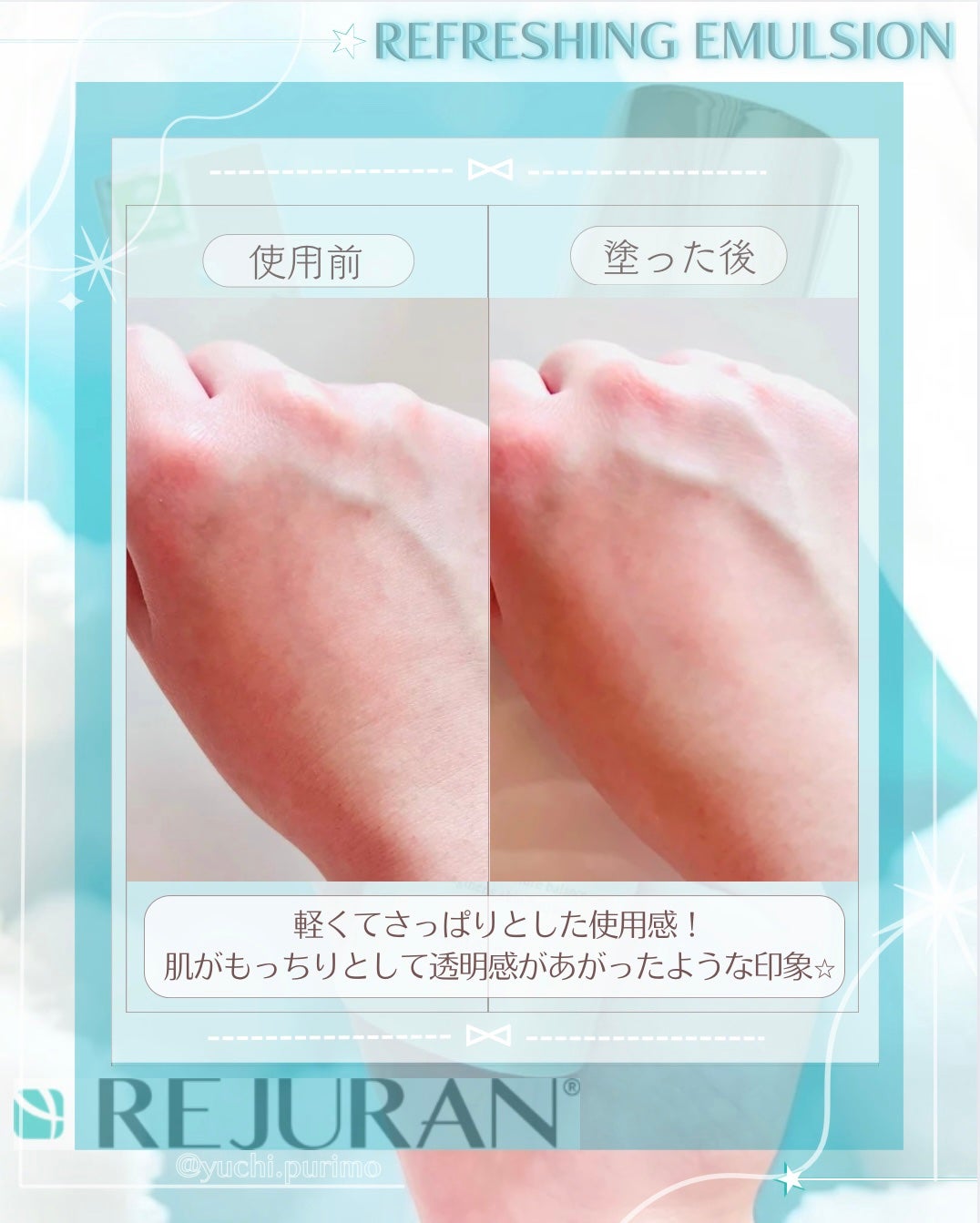 REJURAN リフレッシングエマルジョン 45ml/REJURAN COSMETICS/乳液を使ったクチコミ(4枚目)