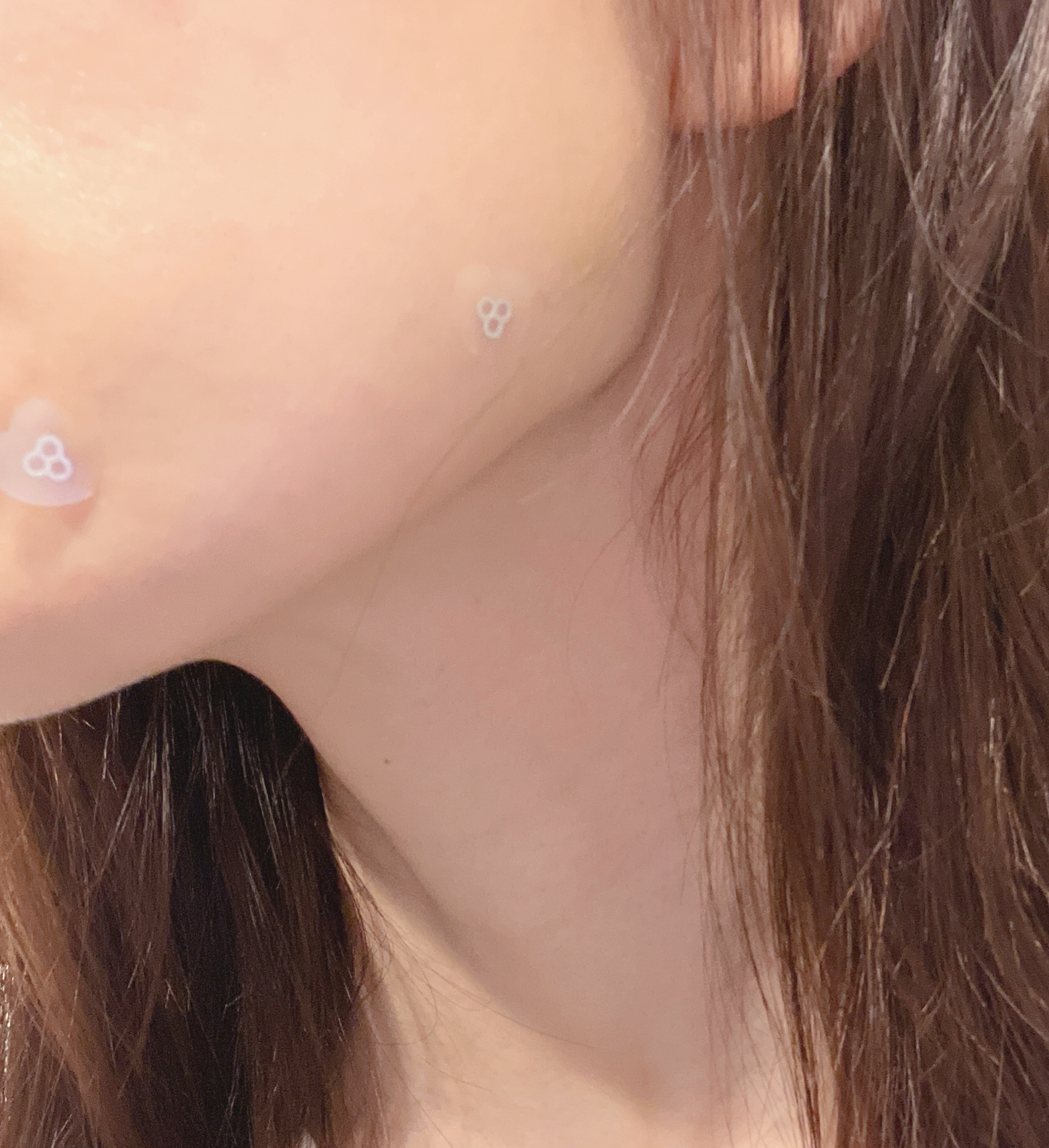 ACマグネシウムパッチプラス 25個入り/スノーツープラス/シートマスク・パックを使ったクチコミ（2枚目）