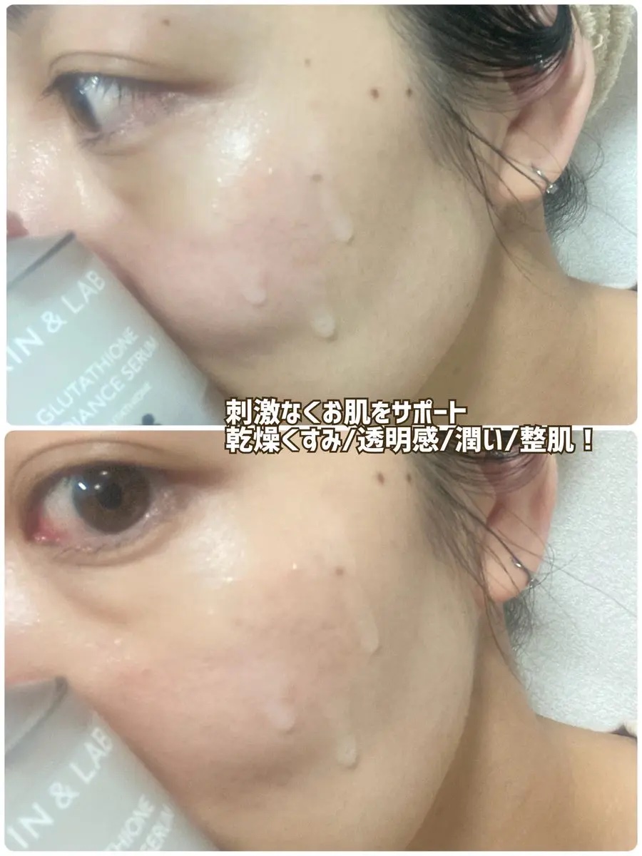 ヴィーガンリポソームレチノールセラム/SKIN&LAB/美容液を使ったクチコミ（3枚目）