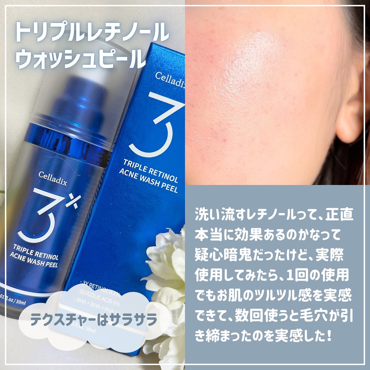 トリプル レチノール ウォッシュピール/Celladix/ピーリングを使ったクチコミ(4枚目)