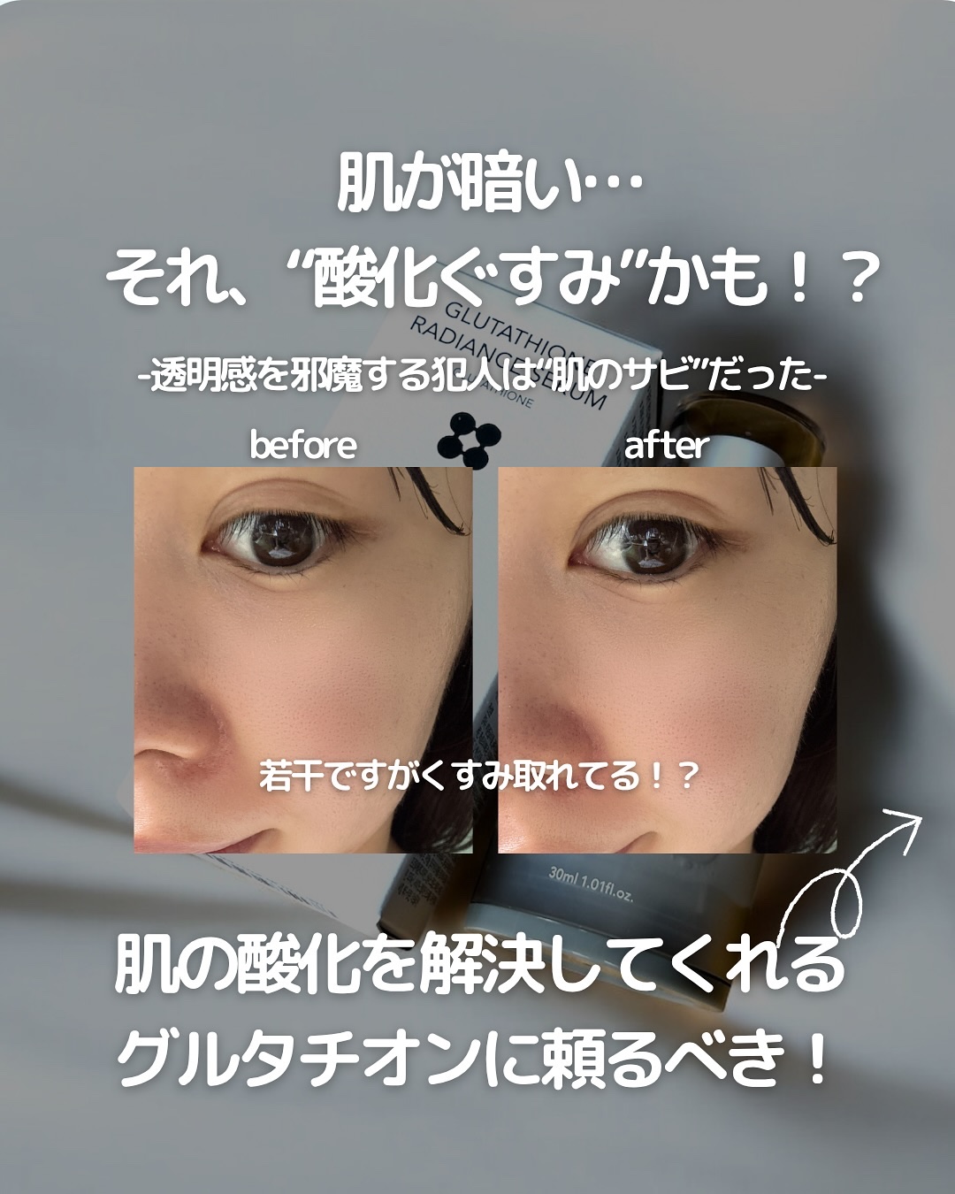 グルタチオンラディアンスセラム/SKIN&LAB/美容液を使ったクチコミ（2枚目）
