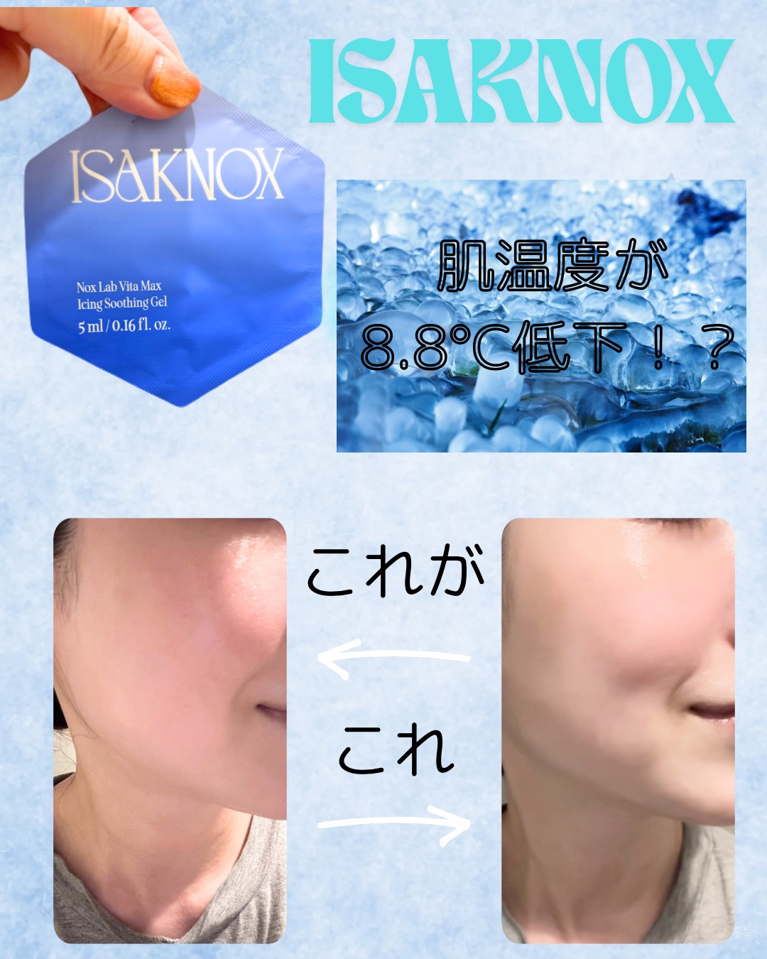 NOX LAB ビタマックス アイシング スージングジェル/ISAKNOX(イザノックス)/フェイスクリームを使ったクチコミ（1枚目）