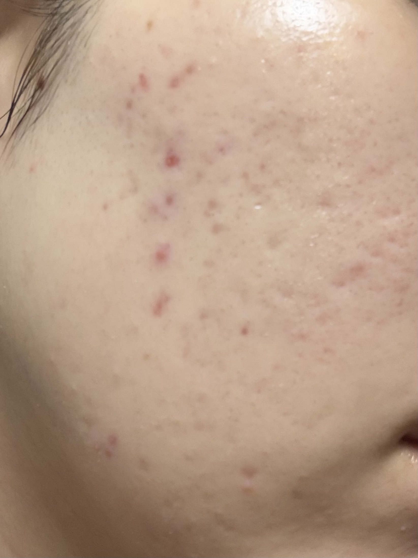 潤浸保湿 化粧水 III とてもしっとり/キュレル/化粧水を使ったクチコミ（1枚目）