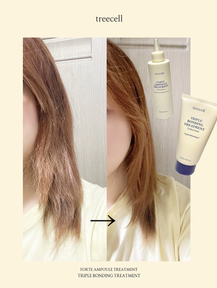 フォルテ アンプル トリートメント/treecell/洗い流すヘアトリートメントを使ったクチコミ(4枚目)