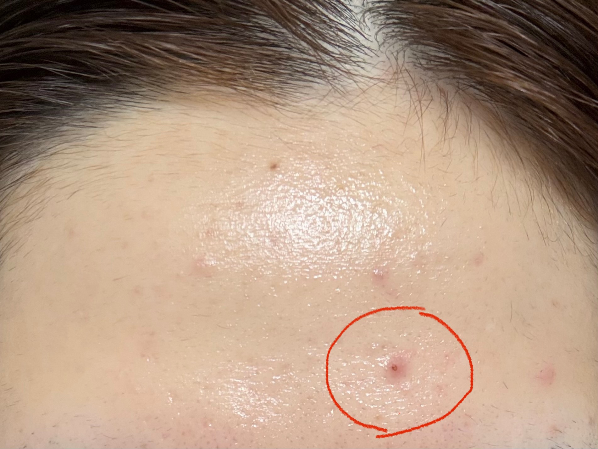 潤浸保湿 化粧水 III とてもしっとり/キュレル/化粧水を使ったクチコミ（3枚目）