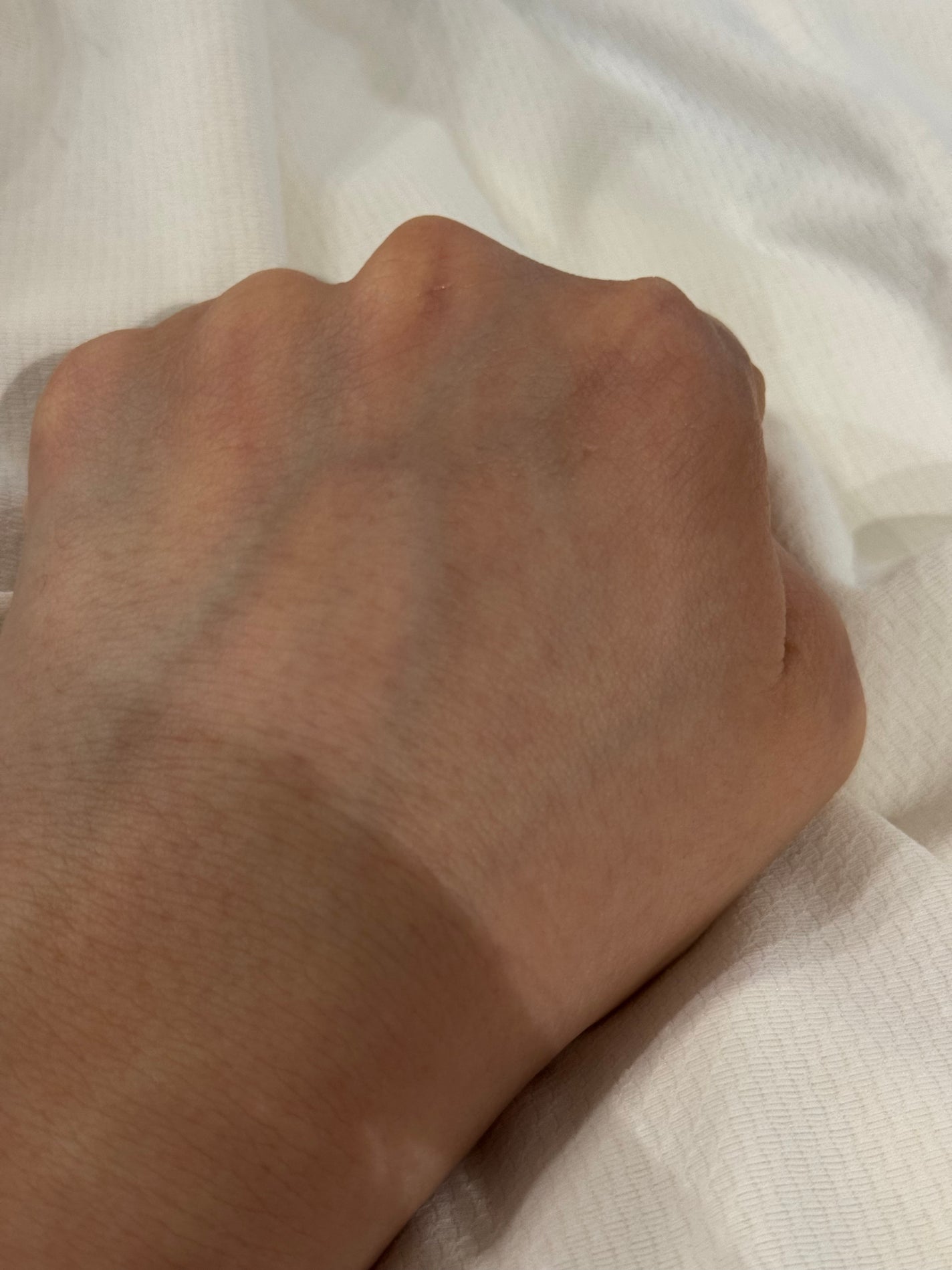 A.Cクリーム プレミアム/LEPOREM/フェイスクリームを使ったクチコミ(4枚目)