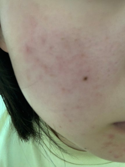 を使ったクチコミ(3枚目)