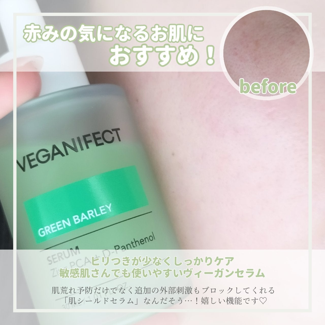 青麦ジンクセラム/Veganifect/美容液を使ったクチコミ(4枚目)