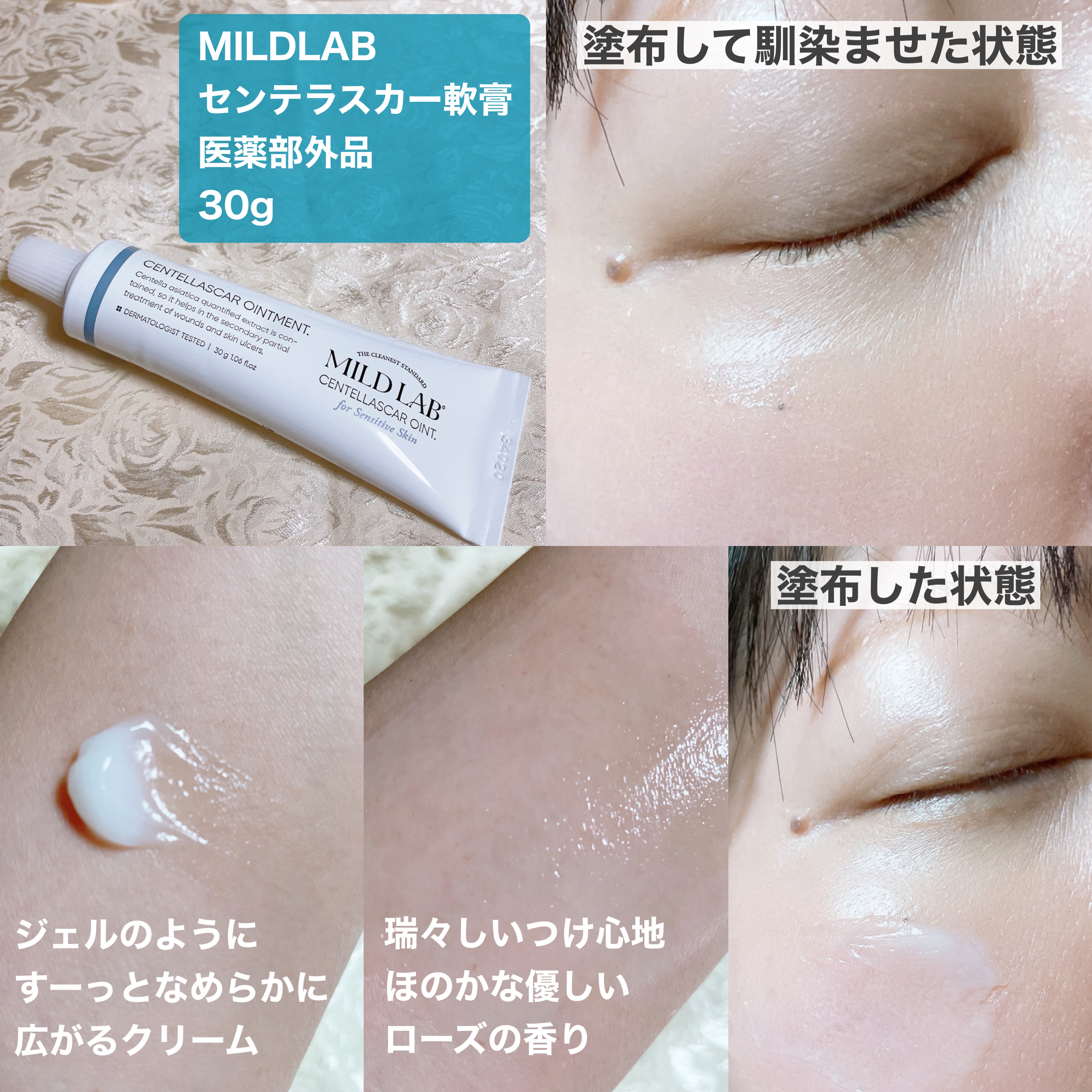センテラスカー 軟膏 (オイントメント)/Mildlab/フェイスクリームを使ったクチコミ（3枚目）