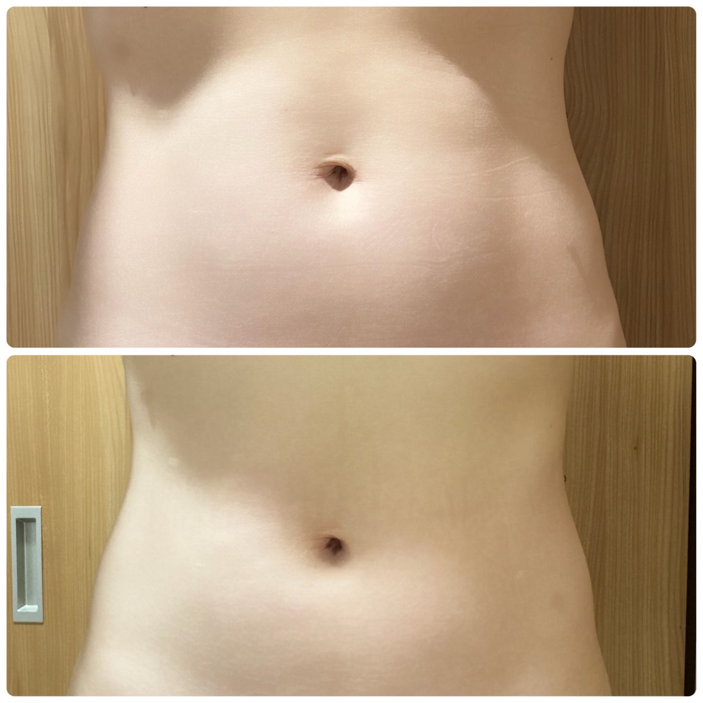 ☆scallop☆フォロバ100%☆ on LIPS 「韓国No.1のダイエット韓医院【ミオル】のピンク丸剤✨その後の..」(1枚目)