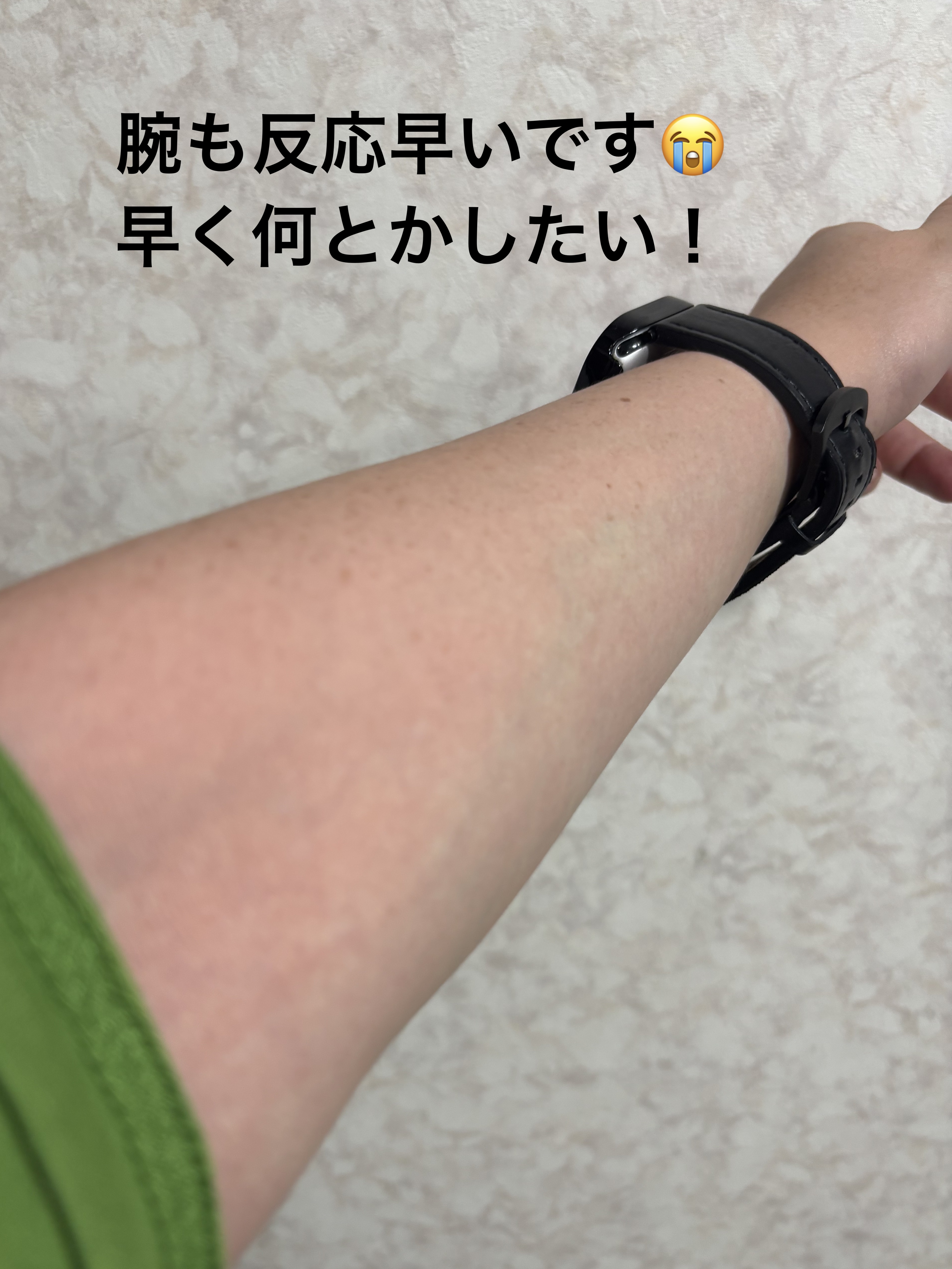 CICAクリームプラス/VT/フェイスクリームを使ったクチコミ（3枚目）