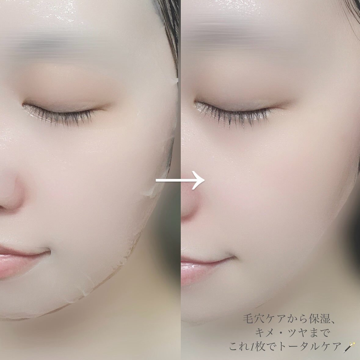 ローゼPDRNエッセンシャルマスクヘルシーグロウ/MEDIHEAL/シートマスク・パックを使ったクチコミ（3枚目）