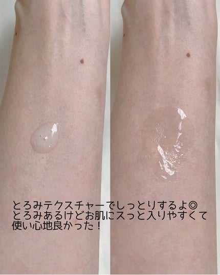 グルタチオンラディアンスセラム/SKIN&LAB/美容液を使ったクチコミ(5枚目)