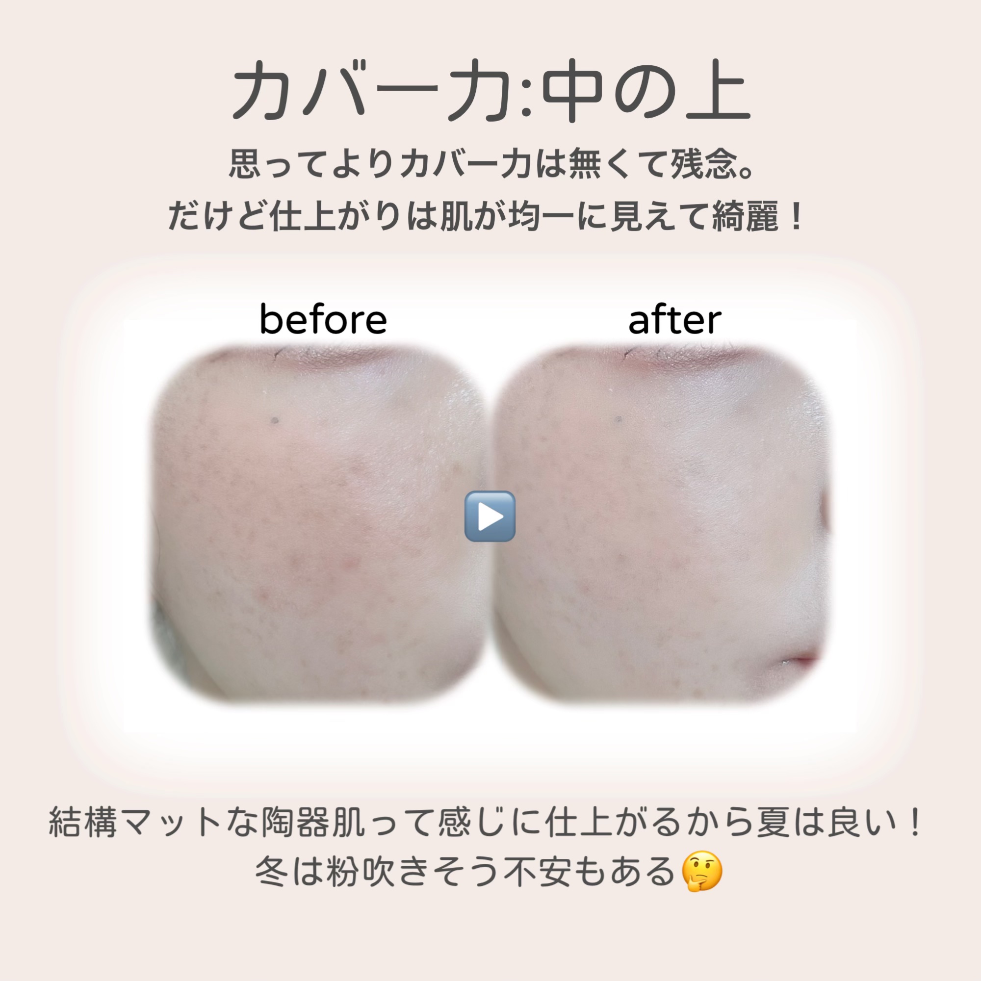 Skin Fit UV Concealer/EITHER＆/リキッドコンシーラーを使ったクチコミ（3枚目）