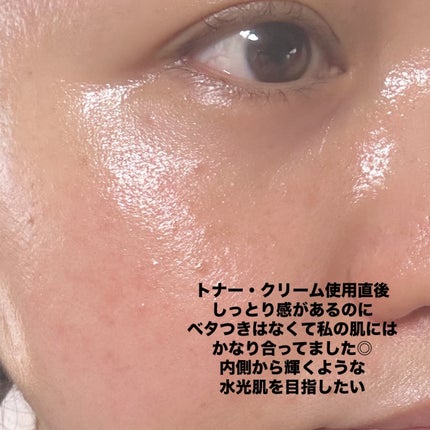 米セラミドエッセンストナー/FULLY/化粧水を使ったクチコミ(6枚目)