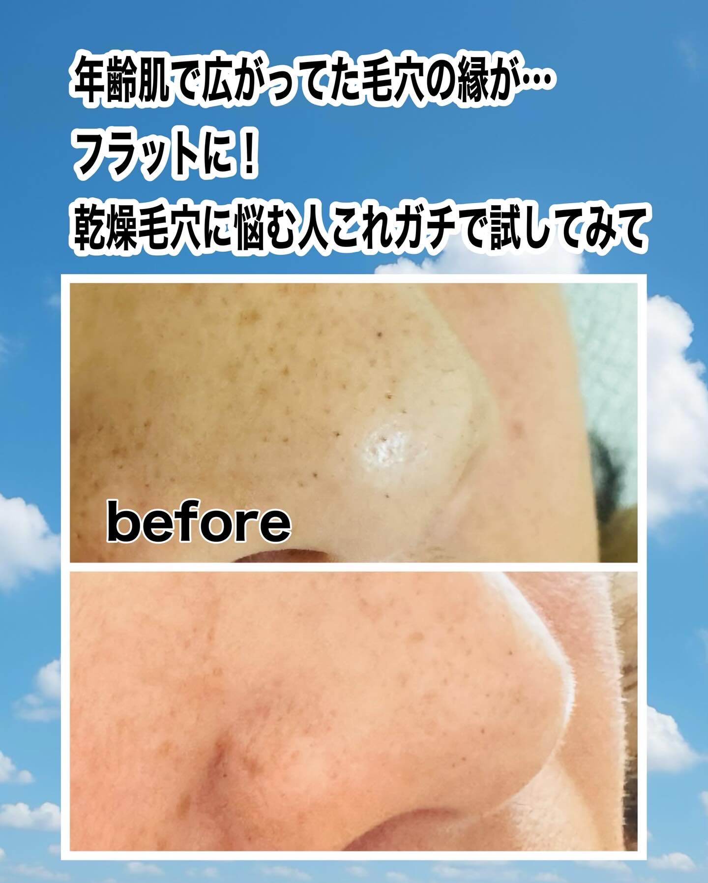 クラウドクリーム/CHARDE/フェイスクリームを使ったクチコミ（1枚目）