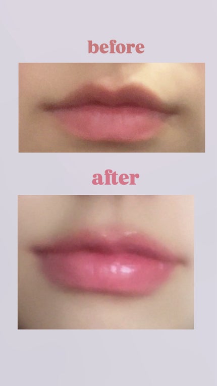 メンソレータム リップフォンデュ/メンソレータム/リップバームを使ったクチコミ(2枚目)