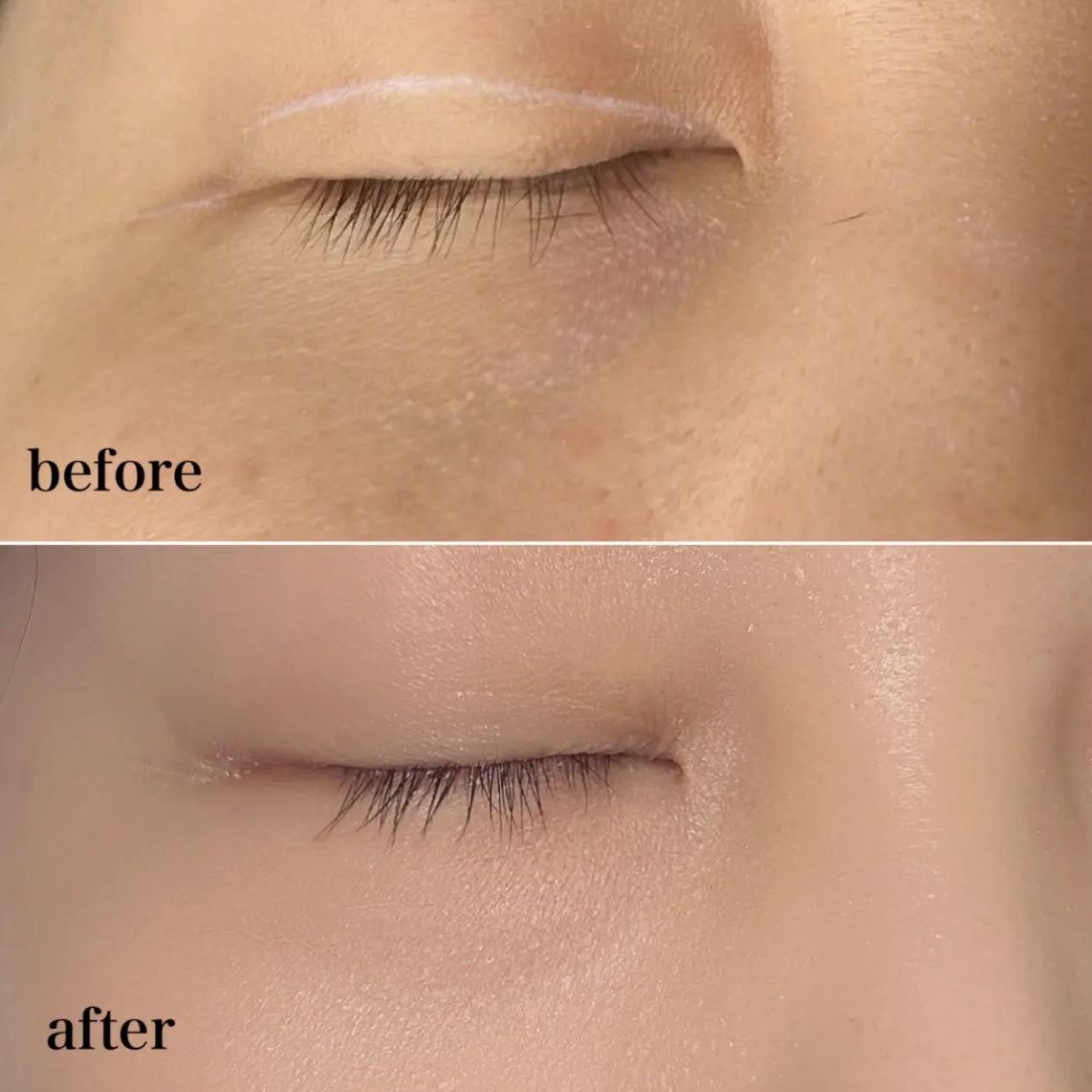 カバーナチュール/アンジエンド/クリームコンシーラーを使ったクチコミ（3枚目）