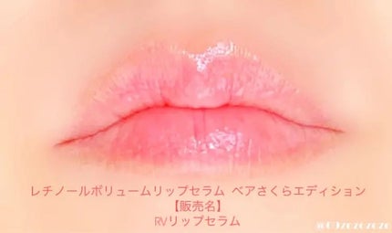 ユース ラディアンス ビタチノール セラム/primera/美容液を使ったクチコミ(2枚目)