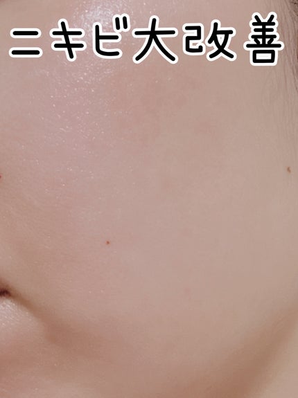 潤浸保湿 化粧水 III とてもしっとり/キュレル/化粧水を使ったクチコミ(1枚目)