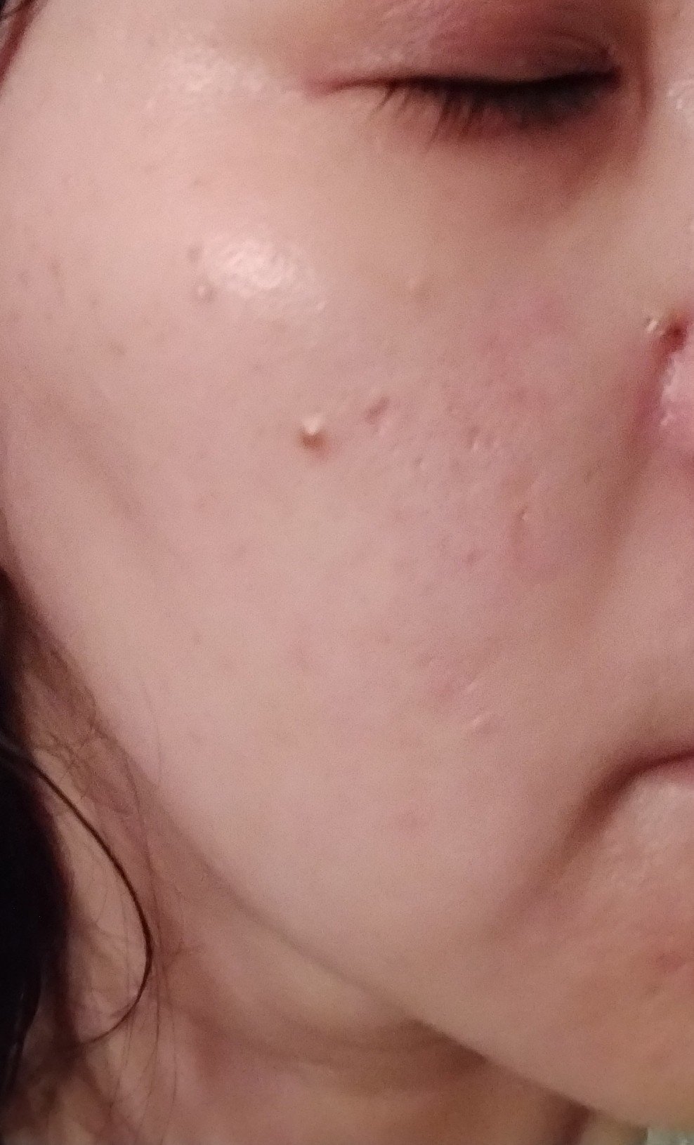 リードルS PDRN+ セラム/VT/美容液を使ったクチコミ（2枚目）