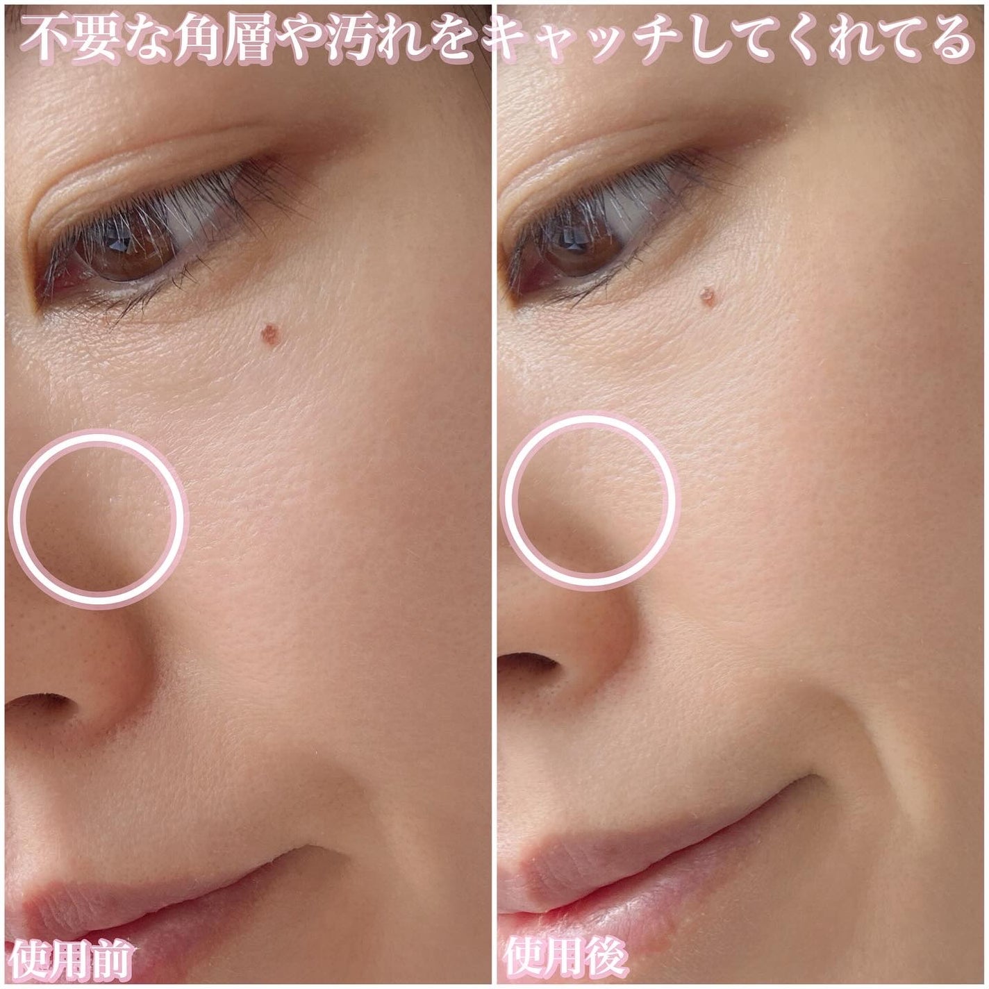 エテュセ ピーリングケアシート/ettusais/ピーリングを使ったクチコミ(5枚目)