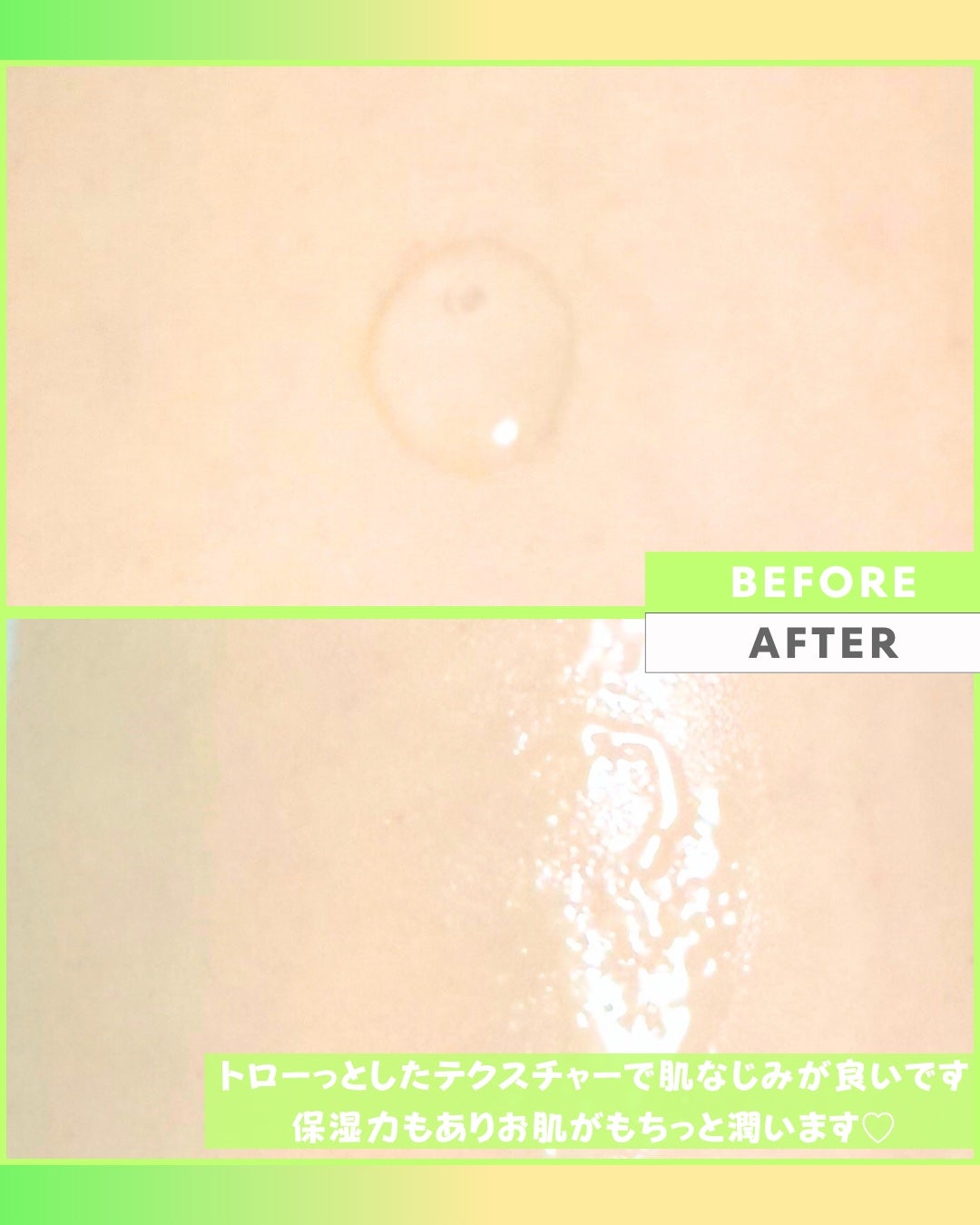 Abo on LIPS 「やっほーAboです🤍✨🌟Dr.G🌟🩷レッドブレミッシュクリアス..」(6枚目)