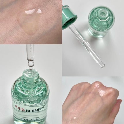 レッドブレミッシュ クリアスージングクリーム/Dr.G/フェイスクリームを使ったクチコミ(3枚目)