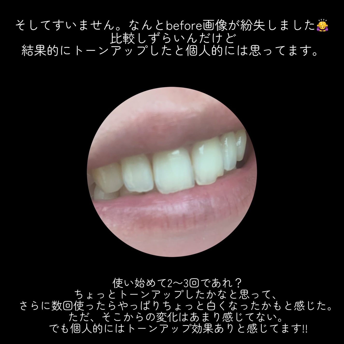 ホワイトパープル歯みがき ピーチフローラルミントの香り/EUTHYMOL/歯磨き粉を使ったクチコミ(6枚目)