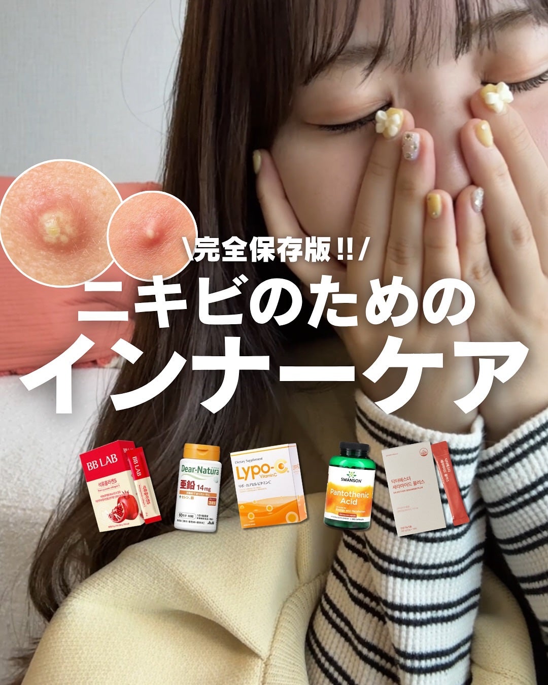 白湯(サユ) | ニキビと戦うOL🤍 on LIPS 「絹です🌿「スキンケアめっちゃ頑張ってるのに、なんでニキビ治らな..」(1枚目)