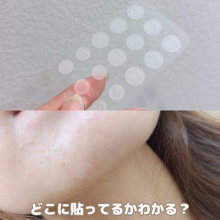 ACマグネシウムパッチ/スノーツープラス/シートマスク・パックを使ったクチコミ(5枚目)