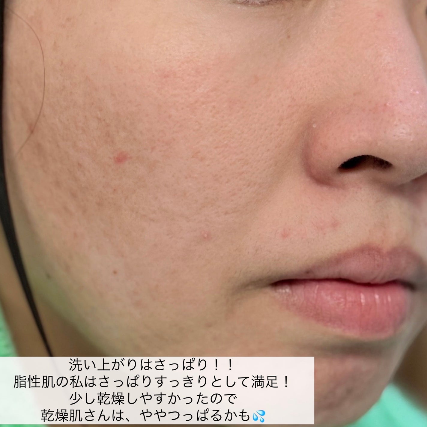 ルルルンクレンジング トーニングバーム MILD BLUE/ルルルン/クレンジングバームを使ったクチコミ(6枚目)