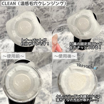 多機能温冷美顔器/ANLAN/美顔器・マッサージを使ったクチコミ(4枚目)