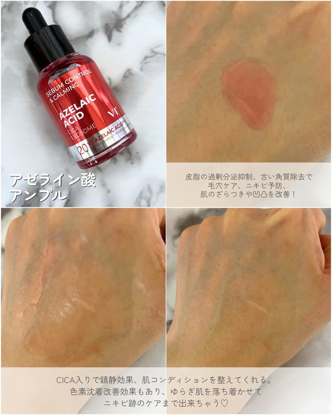 A1カーミング アンプル/VT/美容液を使ったクチコミ(4枚目)