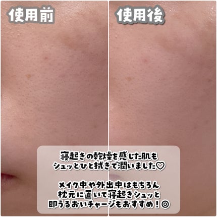 ビタ5X コラーゲン クリーム ミスト/D'amu/ミスト状化粧水を使ったクチコミ(3枚目)