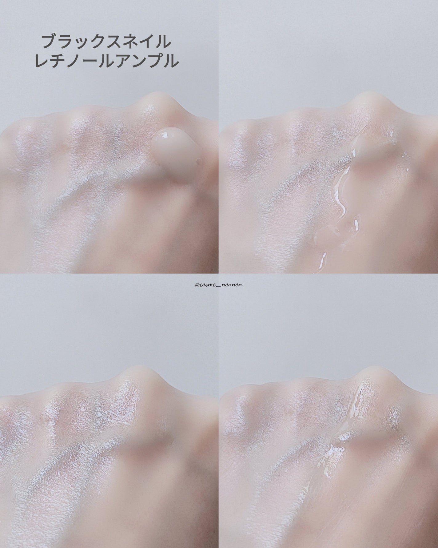 ブラックスネイル クリーム/Dr.G/フェイスクリームを使ったクチコミ(6枚目)