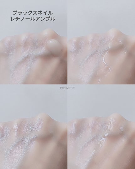 ブラックスネイル クリーム/Dr.G/フェイスクリームを使ったクチコミ(6枚目)