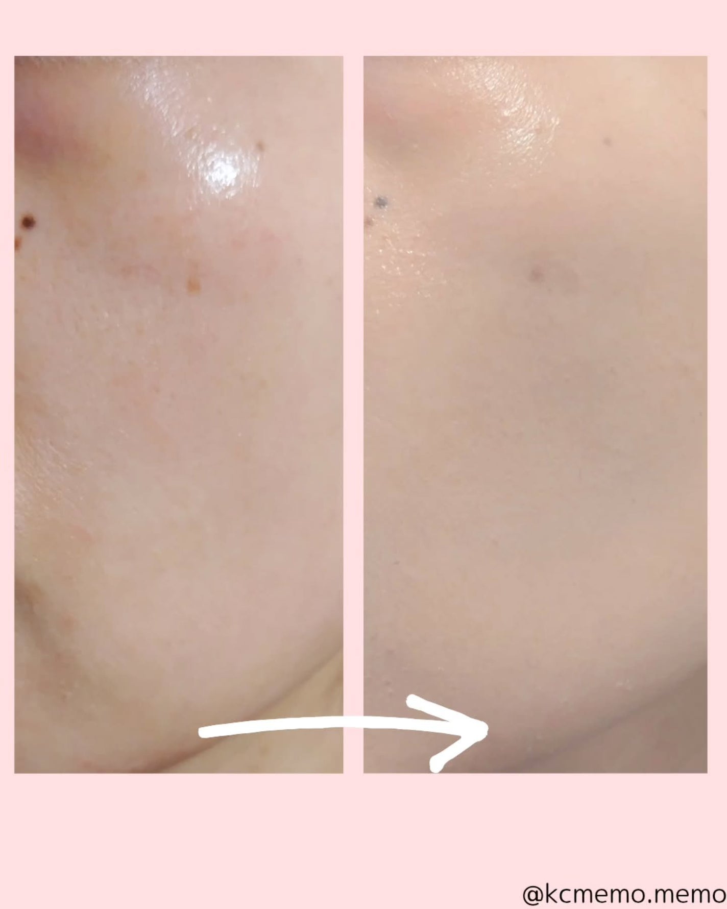 アリウル インクフェザーカバーラスティングクッション/Ariul/クッションファンデーションを使ったクチコミ(4枚目)