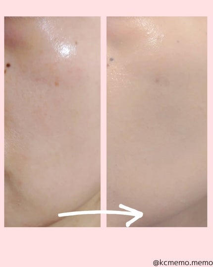 アリウル インクフェザーカバーラスティングクッション/Ariul/クッションファンデーションを使ったクチコミ(4枚目)