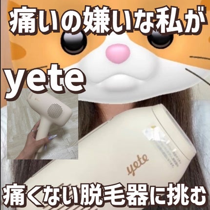 サファイアIPL脱毛器 /yete/家庭用脱毛器を使ったクチコミ(1枚目)
