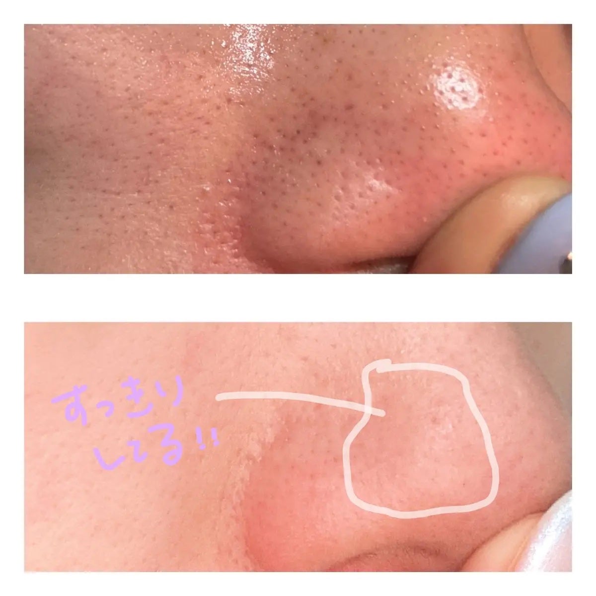 ナチュラルマイルドクリアノーズパック/ilso/シートマスク・パックを使ったクチコミ(4枚目)