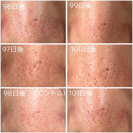 レチノール0.3 ナイアシンリニューイングセラム/Anua/美容液を使ったクチコミ(5枚目)