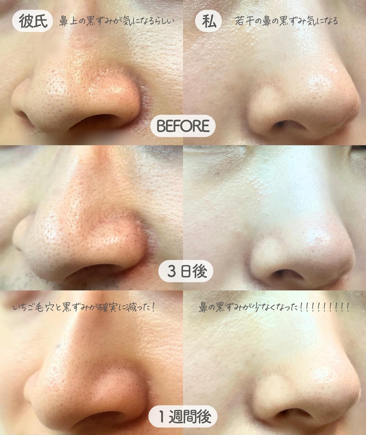 AQ 毛穴美容液オイル/DECORTÉ/フェイスオイルを使ったクチコミ(5枚目)