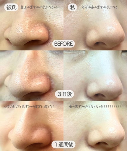 AQ 毛穴美容液オイル/DECORTÉ/フェイスオイルを使ったクチコミ(5枚目)