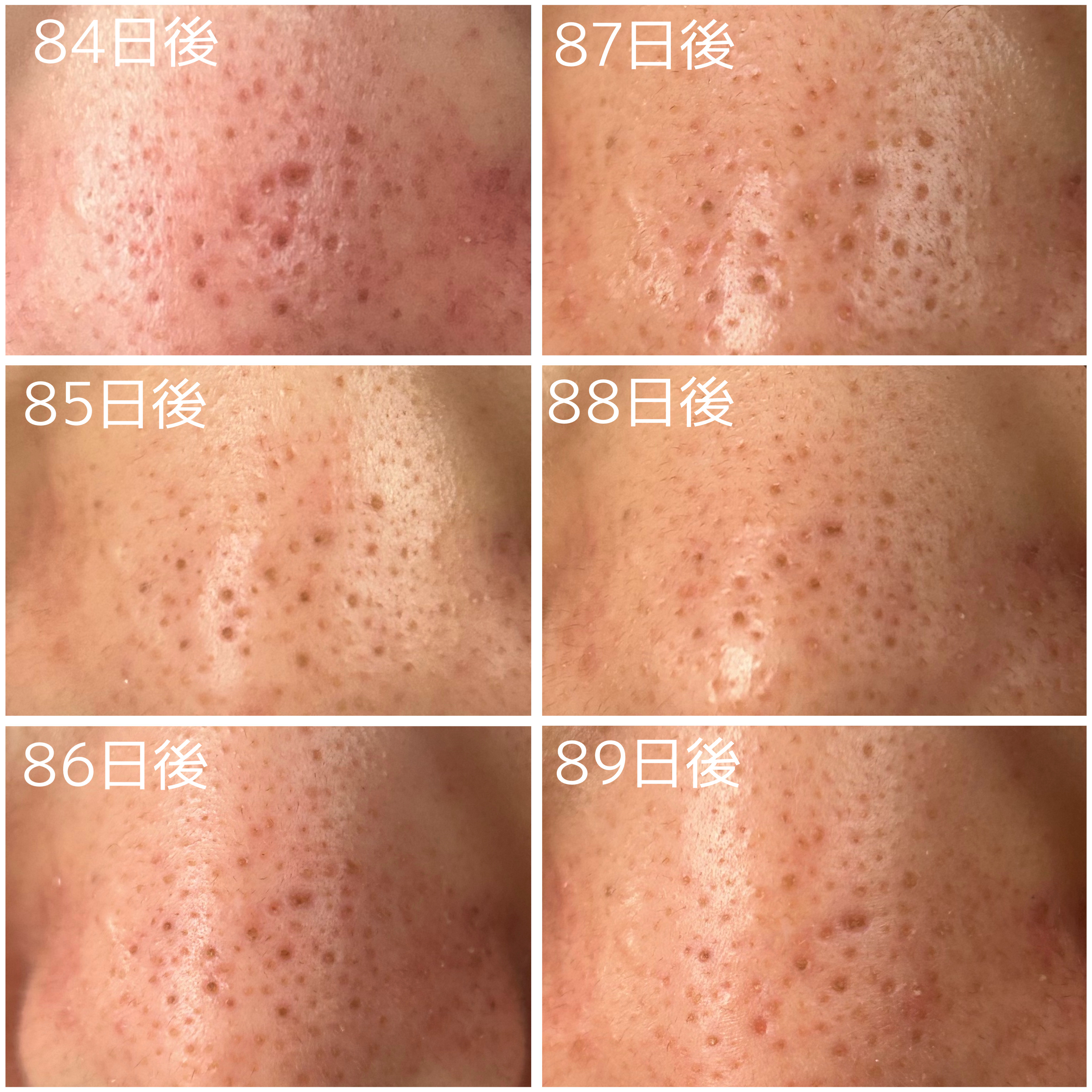 レチノール0.3 ナイアシンリニューイングセラム/Anua/美容液を使ったクチコミ（3枚目）