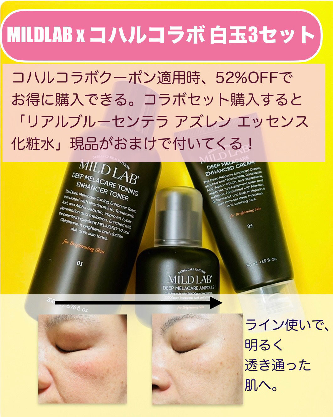 ディープ メラケア 美容液/Mildlab/美容液を使ったクチコミ（3枚目）