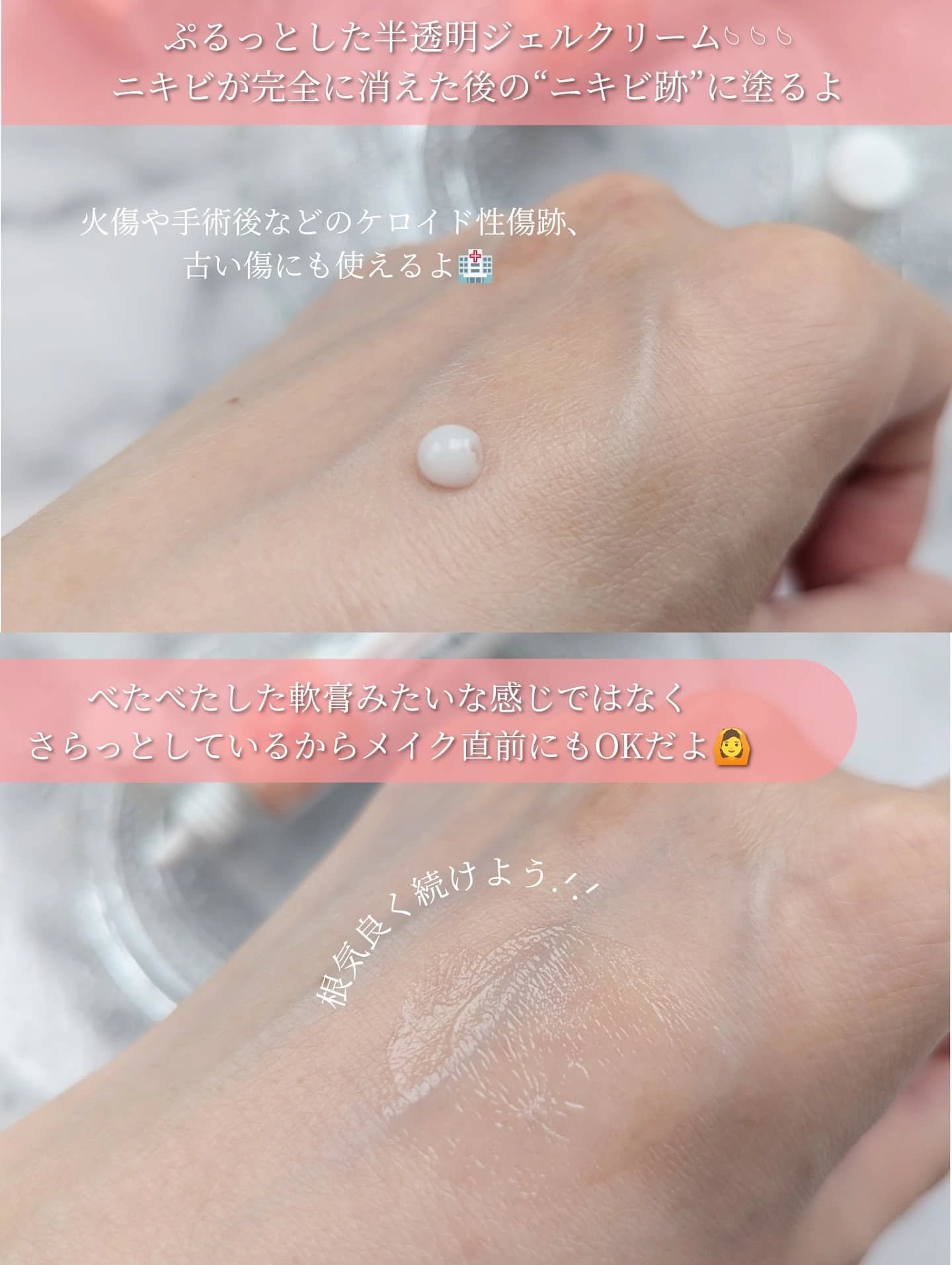 ノスカナゲル/ノスカナゲル/その他スキンケアを使ったクチコミ（3枚目）