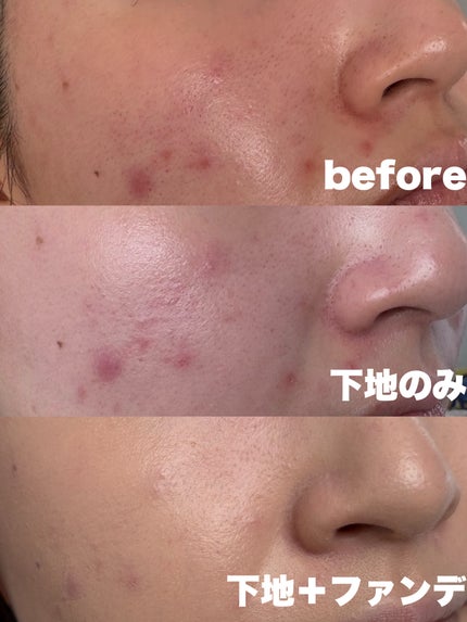 ã¹ã¿ãžãª ãã£ãã¯ã¹ ãã³ã°ãŠãšã¢ ã¯ãã·ã§ã³ ãã¡ã³ããŒã·ã§ã³ SPF 50/Mã»Aã»C/ã¯ãã·ã§ã³ãã¡ã³ããŒã·ã§ã³ã䜿ã£ãã¯ãã³ãïŒ4æç®ïŒ